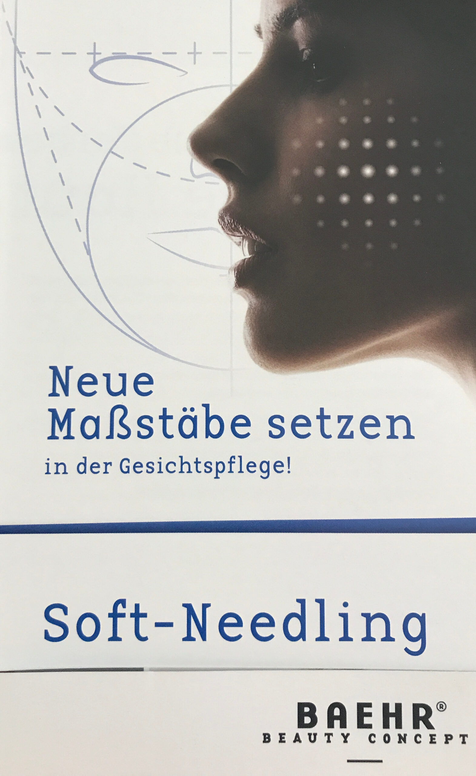 Anja Kremer Behandlung Soft Needling